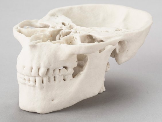 3D печать - череп