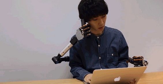 Пользователь держит смартфон возле уха роборуками Metalimbs