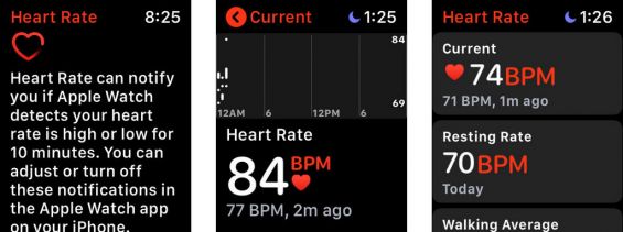 Контроль сердечного ритма на часах Apple Watch Series 4
